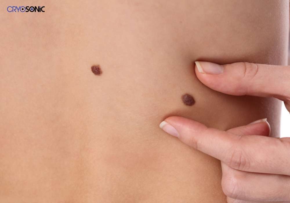 Infection Risk and Poor Aftercare Banbury