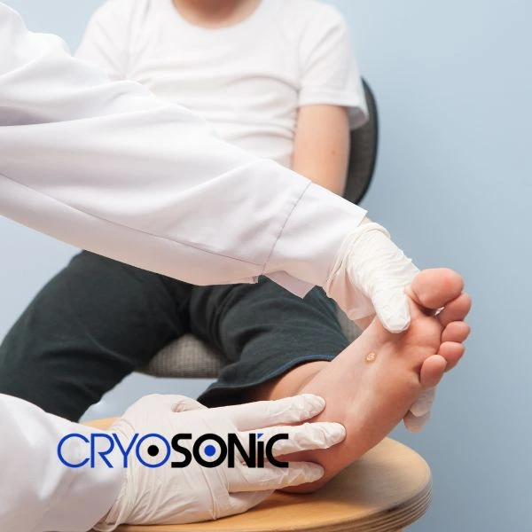 Are you looking for fast effective wart removal Contact us today Banbury